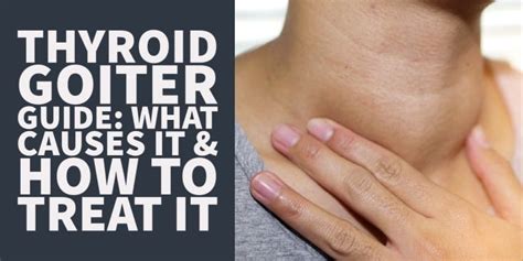 7 Causes Of Thyroid Goiter Treatment And Symptom Guide