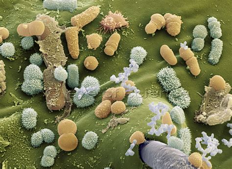 Bacteria And Fungus Seen In The Scanning And Transmission
