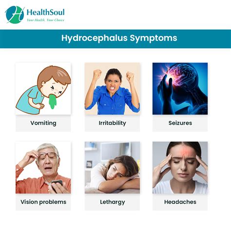 Hydrocephalus Types Symptoms Causes Risk Factors Diagnosis And Porn