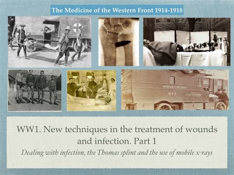 Gcse History Of Medicine Ww1 New Techniques Of Treatment Of Wounds