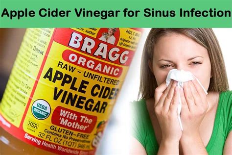 Apple Cider Vinegar For Sinus Infection Treatment Home Remedies For