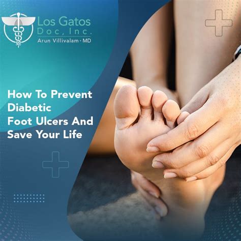 How To Prevent Diabetic Foot Ulcers By Dr Arun Villivalam Medium