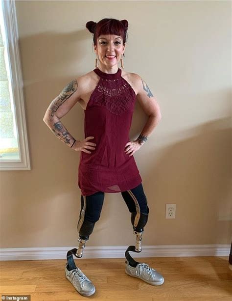 Double Amputee Reveals Moment She Found Out Her Feet Were Coming Off Due To Severe Frostbite