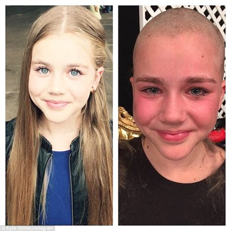 Sydney Girl 11 Who Shaved Hair For Cancer Patients Dreams Of Being A