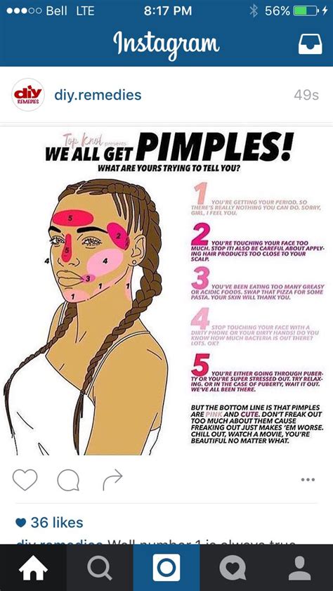 When acne appears during the teenage years, it is more common in males. Pimple chart | Pimples, Pimple chart, Acne skin