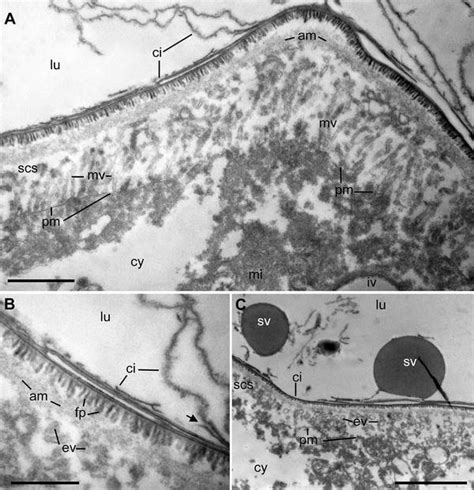 Transmission Electron Micrographs Of A Juveniles Pygidial Gland With A