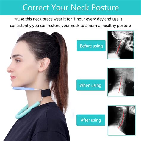 Neck Hump Correctorcervical Collarneck Brace For Neck Pain And