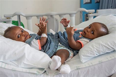 beautiful new photo of former conjoined nigerian twins miracle and testimony ayeni photos