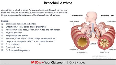 Module Part Bronchial Asthma Cch Meds Your Classroom Youtube
