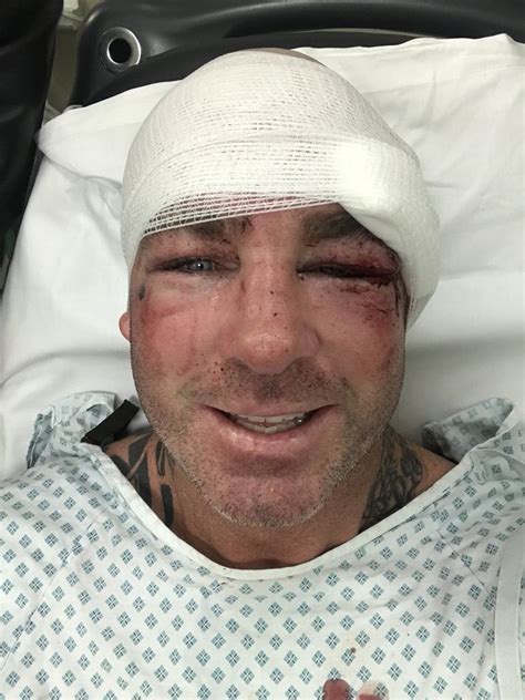 Medics rushed to the heavyweight's side and came. Ben Damon on Twitter: "Lucas Browne has been stitched up ...