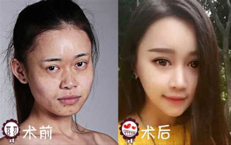Dilraba dilmurat #dilireba #迪丽热巴 #dilrabadilmurat #dilraba #rebaidn #chineseactress. Dilraba Dilmurat Plastic Surgery Before And After - Happy ...