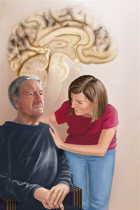 Alzheimers Disease Illustration By Applied Art Llc Medical
