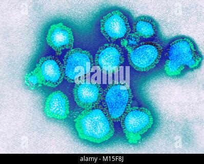 H N Influenza Virus Particles Coloured Transmission Electron