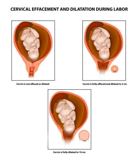 Cervix Dilation Chart Signs Stages And Procedure To Check Artofit