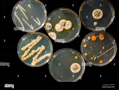 Colonias De Bacterias En Placas Petri Fotografía De Stock Alamy
