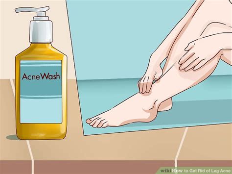 3 Ways To Get Rid Of Leg Acne Wikihow