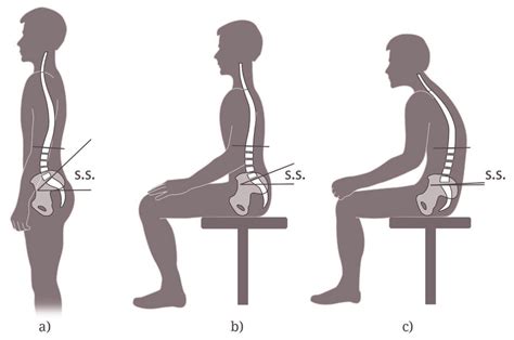 Spinal Curvatures And Pelvic Orientation Are Postural Dependent