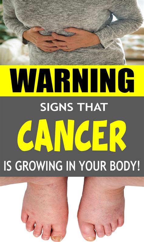 5 Early Cancer Symptoms You Shouldnt Ignore Health And Wellness