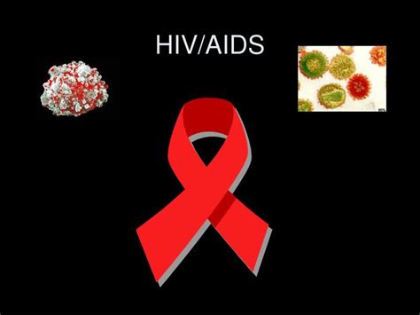 Ppt Hivaids Powerpoint Presentation Free Download Id5901564