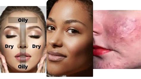 How To Know Your Skin Type How To Take Care Of Oily Skin MoMedia