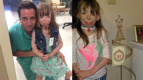 8 Year Old Burn Victim Safyre Terry Wants Nothing But Holiday Cards For Christmas This Year