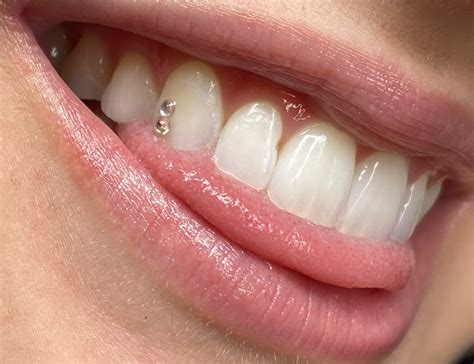 Tooth Gems In Surrey Tooth Charms Vancouver Wake Up Without Makeup