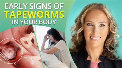 Dont Ignore These Early Signs Of Tapeworms In Your Body Dr J9 Live