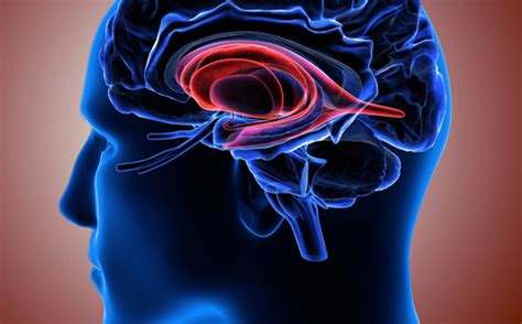 Stimolazione Cerebrale Profonda Awake Surgery Tecniche Di Intervento