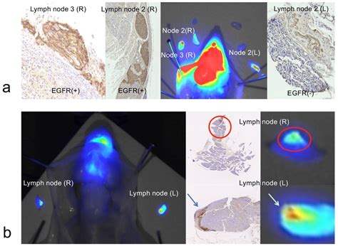 Ijms Free Full Text Imaging Of Metastatic Cancer Cells In Sentinel