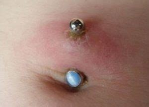 Important: Read This Before Getting a Belly Button Piercing
