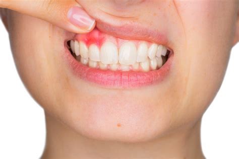 Your Dentist Explains The Difference Between Gum Disease And Oral Cancer