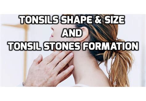 What Is The Link Between Size And Shape Of Tonsils And Tonsil Stones