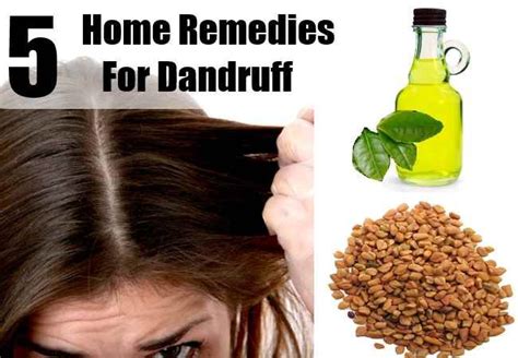 5 Home Remedies For Dandruff Dandruff Remedy Home Remedies For