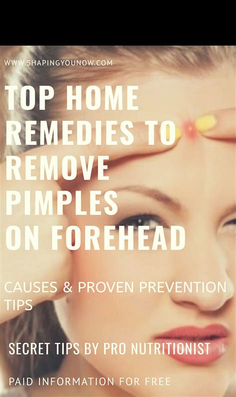 Pimples On Forehead Top Home Remedies Causes And Proven Prevention