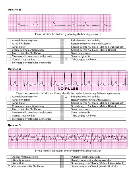Ekg Practice Worksheets With Answers