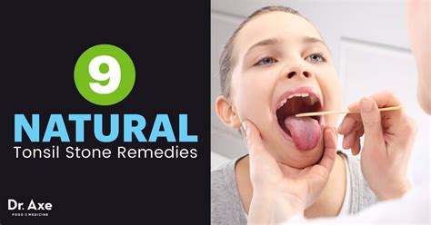 Tonsil Stones Causes Symptoms And Treatment Options Dr Axe