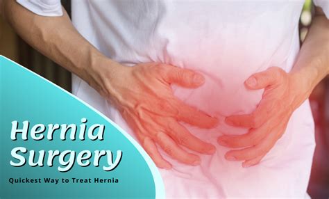 Hernia Surgery In Ahmedabad Quickest Way To Treat Hernia Best