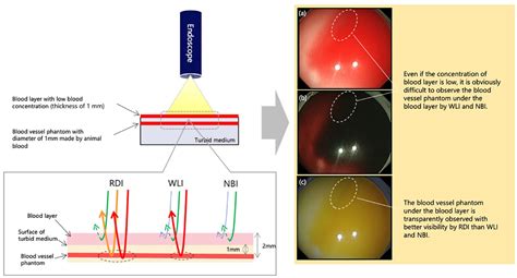 Development And Clinical Usefulness Of A Unique Red Dichromatic Imaging