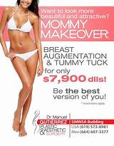 Plastic Surgery Mommy Package Pictures