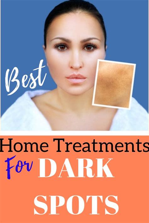 5 Best Dark Spot Home Remedies Living Youthful And Abundant Dark