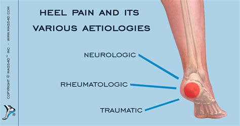 Diagrams Of Heel Pain