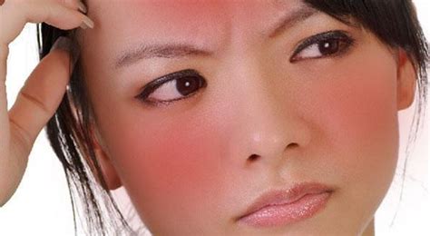 How To Prevent Asian Flush And Stop Your Face From Turning Red