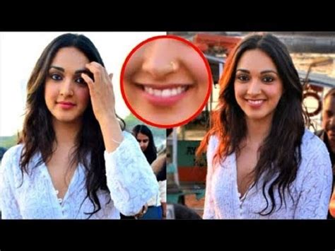 Has Kiara Advani Get Her Nose And Lips Done Plastic Surgery Before And After 247 News Around