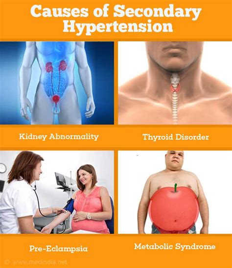 Essential hypertension (or primary) and secondary hypertension. High Blood Pressure | Hypertension - Causes, Symptoms ...