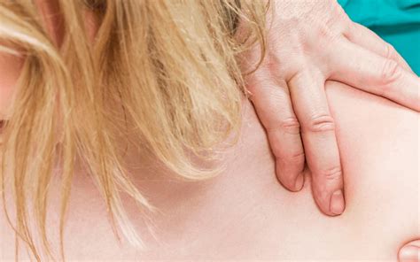 Shoulder Impingement Subacromial Bursitis Porn Sex Picture