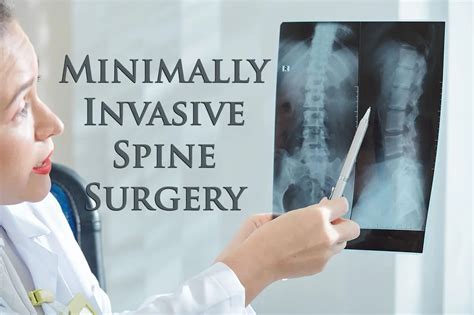Miss Minimally Invasive Spine Surgery Chiropractic Scientist