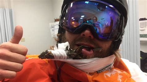 A Ski Instructor Suffered The Most Gruesome Injury