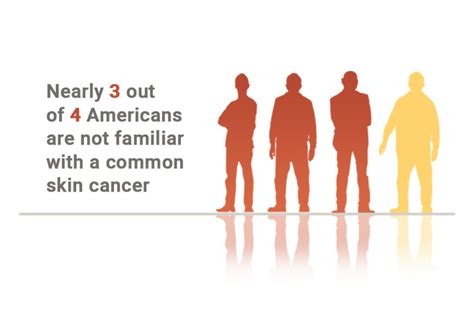 Have You Heard Of Cutaneous Squamous Cell Carcinoma The Skin Cancer Foundation