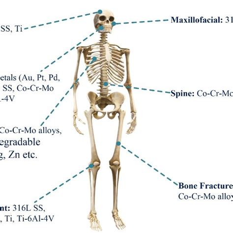 Diagram of a female lower back. Diagram Of Common Back Bone Break : Broken Bones How Do ...