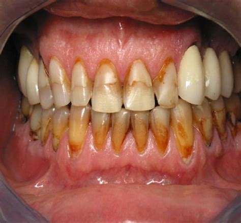 Discolored Teeth Divine Dental Care